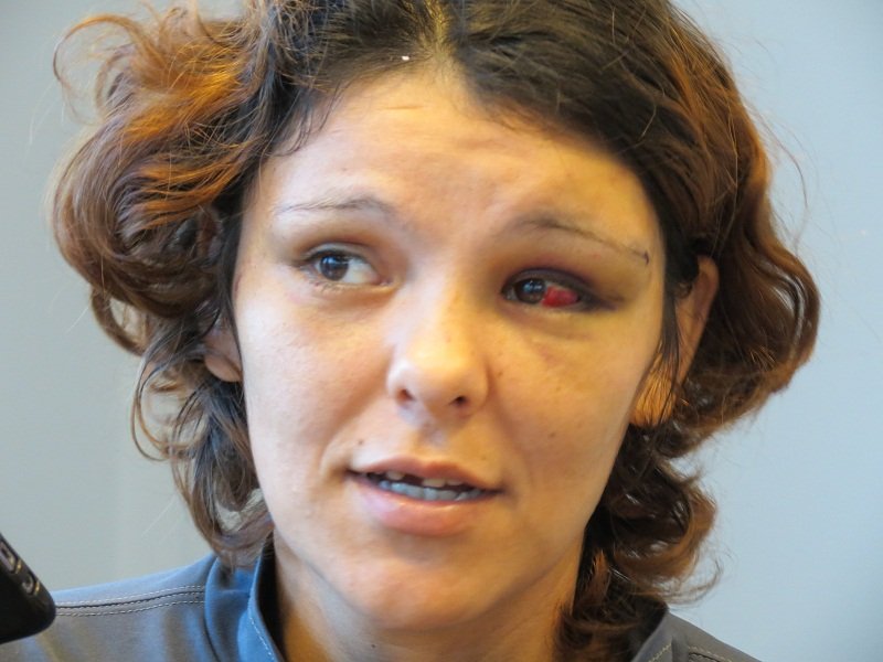 Habló con El Diario la mujer apuñalada por su pareja