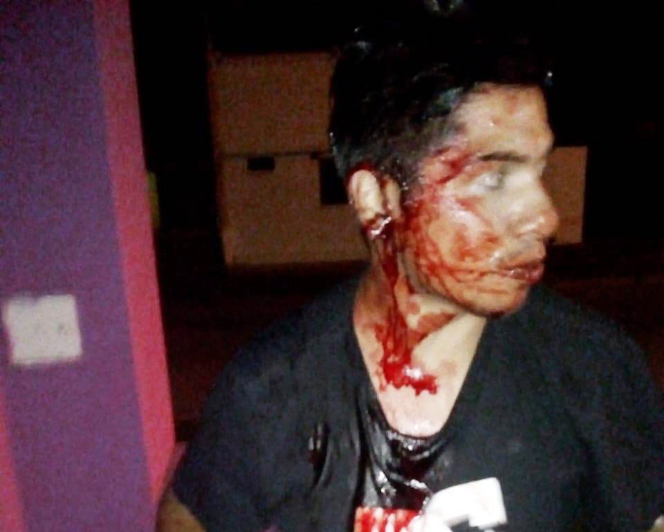 "Patovicas" denunciados por una brutal  agresión a un joven