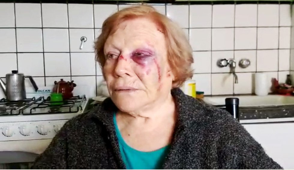 Una brutal agresión y el robo de  $ 20.000 sufrió una jubilada de 84 años