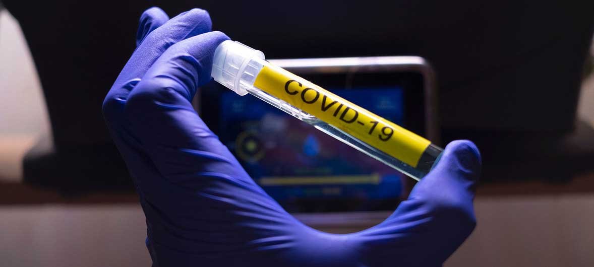 Covid-19: ahora suman 13 los contagiados