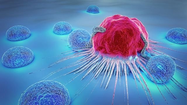 Software desarrollado por argentinos anticipa respuesta de 14 tipos de cáncer frente a tratamientos