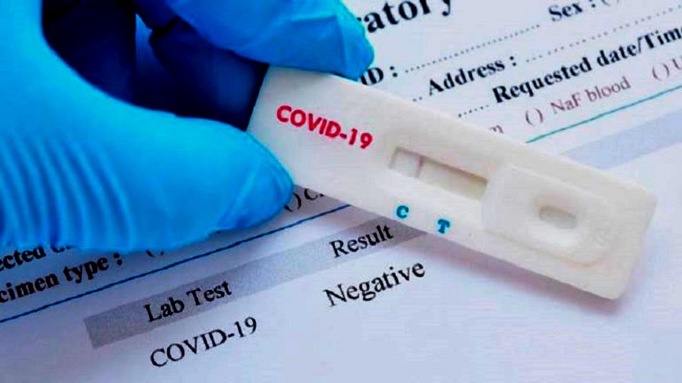 Se prohibió la venta en farmacias de pruebas rápidas para detectar el Coronavirus