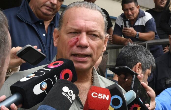 Sergio Berni tras el crimen del colectivero: “No sé si no nos tiraron un muerto”