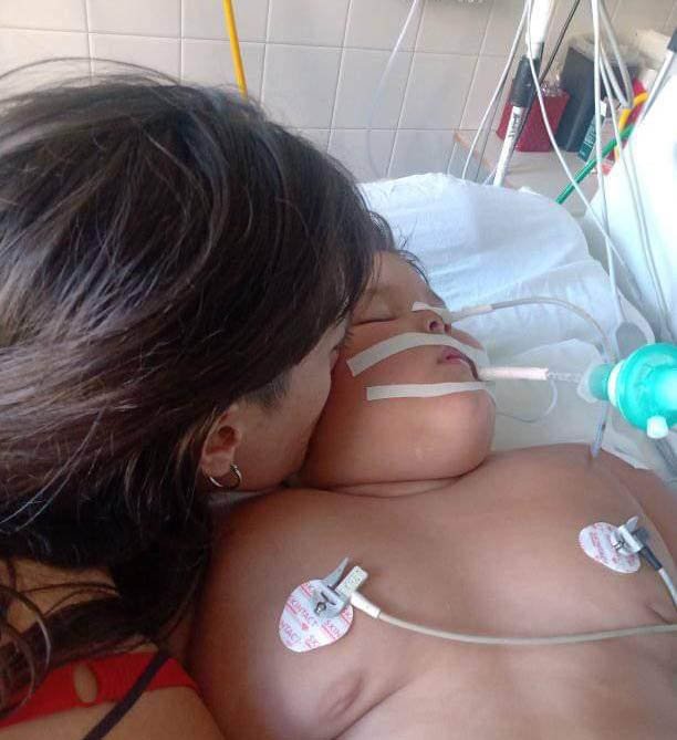 Rodrigo, el niño de 4 años fue operado y evoluciona favorablemente